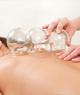 Chiropractic Chandler AZ Cupping Box Chiropractic Chandler AZ Cupping Box